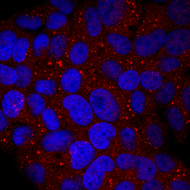 Glucuronosyltransferase 1A1/UGT1A1 was detected in immersion fixed HepG2 human hepatocellular carcinoma cell line using Goat Anti-Human Glucuronosyltransferase 1A1/ UGT1A1 Antigen Affinity-purified Polyclonal Antibody (Catalog # AF6490) at 10 µg/mL for 3 hours at room temperature. Cells were stained using the NorthernLights™ 557-conjugated Anti-Goat IgG Secondary Antibody (red; Catalog # NL001) and counterstained with DAPI (blue). Specific staining was localized to cytoplasm. View our protocol for Fluorescent ICC Staining of Cells on Coverslips.