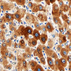Glucuronosyltransferase 1A1/UGT1A1 was detected in immersion fixed paraffin-embedded sections of human liver using Goat Anti-Human Glucuronosyltransferase 1A1/ UGT1A1 Antigen Affinity-purified Polyclonal Antibody (Catalog # AF6490) at 3 µg/mL overnight at 4 °C. Before incubation with the primary antibody, tissue was subjected to heat-induced epitope retrieval using Antigen Retrieval Reagent-Basic (Catalog # CTS013). Tissue was stained using the Anti-Goat HRP-DAB Cell & Tissue Staining Kit (brown; Catalog # CTS008) and counter-stained with hematoxylin (blue). Specific staining was localized to cytoplasm in hepatocytes. View our protocol for Chromogenic IHC Staining of Paraffin-embedded Tissue Sections.