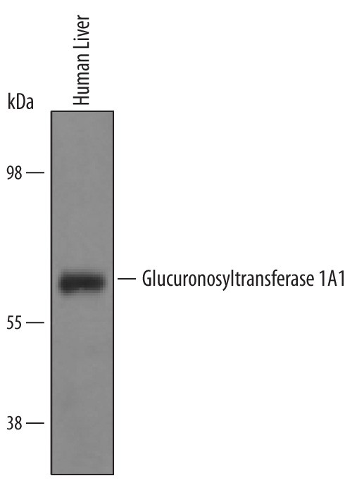 Western blot shows lysates of human liver tissue. PVDF Membrane was probed with 1 µg/mL of Goat Anti-Human Glucuronosyltransferase 1A1/UGT1A1 Antigen Affinity-purified Polyclonal Antibody (Catalog # AF6490) followed by HRP-conjugated Anti-Goat IgG Secondary Antibody (Catalog # HAF019). A specific band was detected for Glucuronosyltransferase 1A1/UGT1A1 at approximately 57 kDa (as indicated). This experiment was conducted under reducing conditions and using Immunoblot Buffer Group 8.