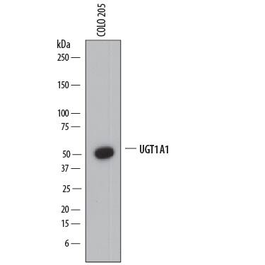 Western blot shows lysates of COLO 205 human colorectal adenocarcinoma cell line. PVDF membrane was probed with 2 µg/mL of Mouse Anti-Human Glucuronosyltransferase 1A1/UGT1A1 Monoclonal Antibody (Catalog # MAB6490) followed by HRP-conjugated Anti-Mouse IgG Secondary Antibody (Catalog # HAF018). A specific band was detected for Glucuronosyltransferase 1A1/UGT1A1 at approximately 50 kDa (as indicated). This experiment was conducted under reducing conditions and using Immunoblot Buffer Group 1.
