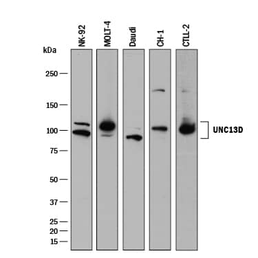 Western blot shows lysates of NK-92 human natural killer lymphoma cell line, MOLT-4 human acute lymphoblastic leukemia cell line, Daudi human Burkitt's lymphoma cell line, CH-1 mouse B cell lymphoma cell line, and CTLL-2 mouse cytotoxic T cell line. PVDF membrane was probed with 0.5 µg/mL of Rabbit Anti-Human/Mouse UNC13D Monoclonal Antibody (Catalog # MAB89662) followed by HRP-conjugated Anti-Rabbit IgG Secondary Antibody (Catalog # HAF008). Specific bands were detected for UNC13D at approximately 95-115 kDa (as indicated). This experiment was conducted under reducing conditions and using Immunoblot Buffer Group 1.