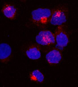 Immunocytochemistry UNC13D/Munc 13-4 Antibody (1222B) [Unconjugated]