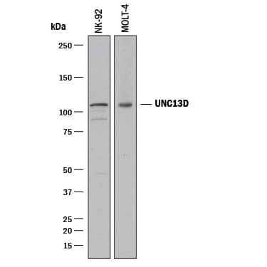 Western Blot UNC13D/Munc 13-4 Antibody (1222B) [Unconjugated]