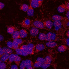 Immunocytochemistry UNC5H1/Unc5a Antibody [Unconjugated]