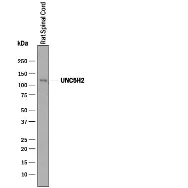 Western Blot UNC5H2/UNC5B Antibody [Unconjugated]