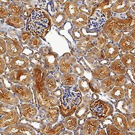 USP2 was detected in perfusion fixed frozen sections of mouse kidney using Goat Anti-Mouse USP2 Antigen Affinity-purified Polyclonal Antibody (Catalog # AF5804) at 3 µg/mL for 1 hour at room temperature followed by incubation with the Anti-Goat IgG VisUCyte™ HRP Polymer Antibody (Catalog # VC004). Tissue was stained using DAB (brown) and counterstained with hematoxylin (blue). Specific staining was localized to cytoplasm in glandular epithelial cells. View our protocol for IHC Staining with VisUCyte HRP Polymer Detection Reagents.