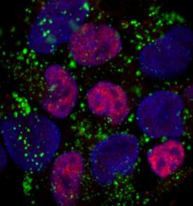 UTF1 was detected in immersion fixed BG01V human embryonic stem cells using Goat Anti-Human UTF1 Antigen Affinity-purified Polyclonal Antibody (Catalog # AF3958) at 10 µg/mL for 3 hours at room temperature. Cells were stained using the NorthernLights™ 557-conjugated Anti-Goat IgG Secondary Antibody (red; Catalog # NL001). SSEA4 was also detected using Mouse Anti-Human SSEA4 Monoclonal Antibody (Catalog # MAB1435) and stained using the NorthernLights™ 493-conjugated Anti-Goat IgG Secondary Antibody (green; Catalog # NL003). Cells were counterstained with DAPI (blue). Specific staining of UTF1 was localized to nuclei. View our protocol for Fluorescent ICC Staining of Stem Cells on Coverslips.