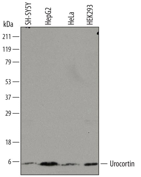 Western Blot Urocortin Antibody (749606)