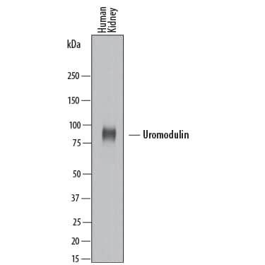 Western Blot Uromodulin Antibody [Unconjugated]