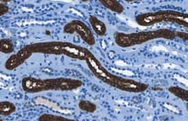 Uromodulin was detected in formalin fixed paraffin-embedded sections of human ovary tissue using Mouse Anti-Human Uromodulin Monoclonal Antibody (Catalog # MAB5144) at 5 µg/mL overnight at 4 °C. Tissue was stained using the Anti-Mouse HRP-DAB Cell & Tissue Staining Kit (brown; Catalog # CTS002) and counterstained with hematoxylin (blue). Specific staining was localized to epithelial cells in convoluted tubules. View our protocol for Chromogenic IHC Staining of Paraffin-embedded Tissue Sections.