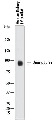 Western blot shows lysates of human kidney (medulla) tissue. PVDF membrane was probed with 2 µg/mL of Mouse Anti-Human Uromodulin Monoclonal Antibody (Catalog # MAB5144) followed by HRP-conjugated Anti-Mouse IgG Secondary Antibody (Catalog # HAF018). A specific band was detected for Uromodulin at approximately 90 kDa (as indicated). This experiment was conducted under reducing conditions using Immunoblot Buffer Group 1.