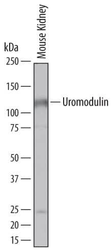 Western Blot Uromodulin Antibody (774056)