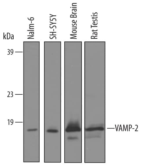 Western blot shows lysates of Nalm-6 human Pre-B acute lymphocytic leukemia cell line, SH-SY5Y human neuroblastoma cell line, mouse brain tissue, and rat testis tissue. PVDF membrane was probed with 1 µg/mL of Goat Anti-Human/Mouse/Rat VAMP-2 Antigen Affinity-purified Polyclonal Antibody (Catalog # AF5136) followed by HRP-conjugated Anti-Goat IgG Secondary Antibody (Catalog # HAF019). A specific band was detected for VAMP-2 at approximately 13 kDa (as indicated). This experiment was conducted under reducing conditions and using Immunoblot Buffer Group 8.