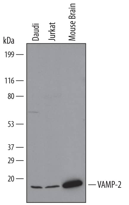 Western blot shows lysates of Daudi human Burkitt's lymphoma cell line, Jurkat human acute T cell leukemia cell line, and mouse brain tissue. PVDF Membrane was probed with 0.1 µg/mL of Mouse Anti-Human/Mouse VAMP-2 Monoclonal Antibody (Catalog # MAB5136) followed by HRP-conjugated Anti-Mouse IgG Secondary Antibody (Catalog # HAF007). A specific band was detected for VAMP-2 at approximately 13 kDa (as indicated). This experiment was conducted under reducing conditions and using Immunoblot Buffer Group 1.