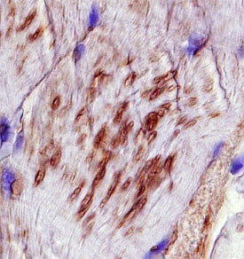 VAMP-5 was detected in immersion fixed paraffin-embedded sections of human skeletal muscle using Sheep Anti-Human VAMP-5 Antigen Affinity-purified Polyclonal Antibody (Catalog # AF7366) at 15 µg/mL overnight at 4 °C. Tissue was stained using the Anti-Sheep HRP-DAB Cell & Tissue Staining Kit (brown; Catalog # CTS019) and counterstained with hematoxylin (blue). Specific staining was localized to sarcoplasm of muscle cells. View our protocol for Chromogenic IHC Staining of Paraffin-embedded Tissue Sections.