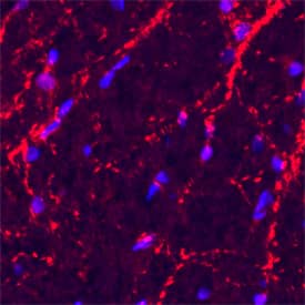 Vesicle-Associate Membrane Protein 2 (VAMP-2) was detected in perfusion-fixed frozen sections of rat spinal cord using a Goat Anti-Human/Mouse/Rat VAMP-2 Antigen Affinity-purified Polyclonal Antibody (Catalog # AF5136). The cells were stained with the NorthernLights 557-conjugated Donkey Anti-Goat IgG Affinity-purified Secondary Antibody (red; Catalog # NL001). The cell nuclei were counterstained with DAPI (blue). VAMP-2 immunoreactivity was localized to synaptic vesicles. View our protocol for Fluorescent IHC Staining of Frozen Tissue Sections.