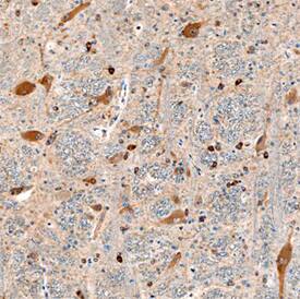 VAP-A was detected in immersion fixed paraffin-embedded sections of human brain using Mouse Anti-Human VAP-A Monoclonal Antibody (Catalog # MAB5820) at 15 µg/mL overnight at 4 °C. Before incubation with the primary antibody, tissue was subjected to heat-induced epitope retrieval using Antigen Retrieval Reagent-Basic (Catalog # CTS013). Tissue was stained using the Anti-Mouse HRP-DAB Cell & Tissue Staining Kit (brown; Catalog # CTS002) and counterstained with hematoxylin (blue). Specific staining was localized to neuronal cell bodies and processes. View our protocol for Chromogenic IHC Staining of Paraffin-embedded Tissue Sections.