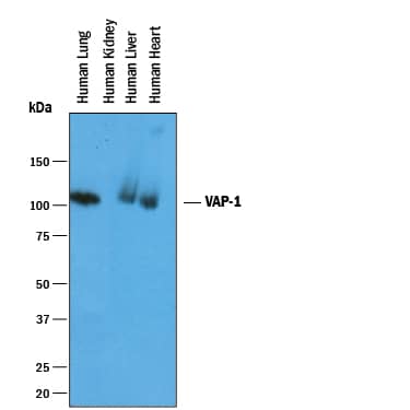 Western blot shows lysates of human lung tissue, human kidney tissue, human liver tissue, and human heart tissue. PVDF membrane was probed with 1 µg/mL of Goat Anti-Human VAP-1/AOC3 Antigen Affinity-purified Polyclonal Antibody (Catalog # AF3957) followed by HRP-conjugated Anti-Goat IgG Secondary Antibody (Catalog # HAF019). A specific band was detected for VAP-1/AOC3 at approximately 95-100 kDa (as indicated). This experiment was conducted under reducing conditions and using Immunoblot Buffer Group 1.