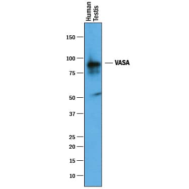 Western Blot VASA Antibody [Unconjugated]