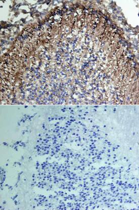 VCAM-1/CD106 was detected in immersion fixed frozen sections of mouse embryo using Goat Anti-Mouse VCAM-1/CD106 Antigen Affinity-purified Polyclonal Antibody (Catalog # AF643) at 15 µg/mL overnight at 4 °C. Tissue was stained using the Anti-Goat HRP-DAB Cell & Tissue Staining Kit (brown; CTS008) and counterstained with hematoxylin (blue). Lower panel shows a lack of labeling if primary antibodies are omitted and tissue is stained only with secondary antibody followed by incubation with detection reagents. View our protocol for Chromogenic IHC Staining of Frozen Tissue Sections.