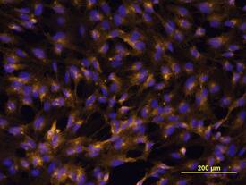 VCAM-1/CD106 was detected in immersion fixed HUVEC human umbilical vein endothelial cells using Human VCAM-1/CD106 Monoclonal Antibody (Catalog # BBA5) at 10 µg/mL for 3 hours at room temperature. Cells were stained using the Northern-Lights™ 557-conjugated Anti-Mouse IgG Secondary Antibody (yellow; Catalog # NL007) and counter-stained with DAPI (blue). View our protocol for Fluorescent ICC Staining of Cells on Coverslips.This antibody is not suitable for labeling formalin-fixed, paraffin-embedded tissue.