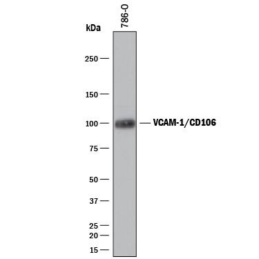 Western blot shows lysates of 786-O human renal cell adenocarcinoma cell line. PVDF membrane was probed with 2 µg/mL of Sheep Anti-Human VCAM-1/ CD106 Antigen Affinity-purified Polyclonal Antibody (Catalog # AF809) followed by HRP-conjugated Anti-Sheep IgG Secondary Antibody (Catalog # HAF016). A specific band was detected for VCAM-1/CD106 at approximately 100 kDa (as indicated). This experiment was conducted under reducing conditions and using Immunoblot Buffer Group 1.
