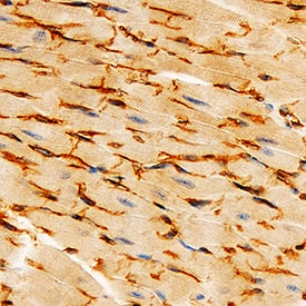 VE-Cadherin was detected in immersion fixed paraffin-embedded sections of mouse heart using Goat Anti-Mouse VE-Cadherin Antigen Affinity-purified Polyclonal Antibody (Catalog # AF1002) at 3 µg/mL for 1 hour at room temperature followed by incubation with the Anti-Goat IgG VisUCyte™ HRP Polymer Antibody (Catalog # VC004). Tissue was stained using DAB (brown) and counterstained with hematoxylin (blue). Specific staining was localized to cell membranes. View our protocol for IHC Staining with VisUCyte HRP Polymer Detection Reagents.