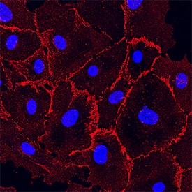 VE-Cadherin was detected in immersion fixed HUVEC human umbilical vein endothelial cells using Goat Anti-Human VE-Cadherin Antigen Affinity-purified Polyclonal Antibody (Catalog # AF938) at 10 µg/mL for 3 hours at room temperature. Cells were stained using the NorthernLights™ 557-conjugated Anti-Goat IgG Secondary Antibody (red; NL001) and counterstained with DAPI (blue). Specific staining was localized to the plasma membrane. View our protocol for Fluorescent ICC Staining of Cells on Coverslips.
