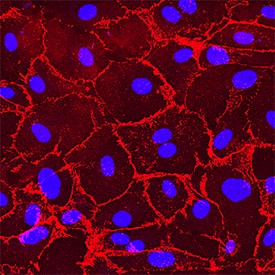 VE-Cadherin was detected in immersion fixed HUVEC cells using Mouse Anti-Human VE-Cadherin Monoclonal Antibody (Catalog # MAB9381) at 0.5 µg/mL for 3 hours at room temperature. Cells were stained using the NorthernLights™ 557-conjugated Anti-Mouse IgG Secondary Antibody (red; Catalog # NL007) and counterstained with DAPI (blue). Specific staining was localized to plasma membrane. View our protocol for Fluorescent ICC Staining of Cells on Coverslips.