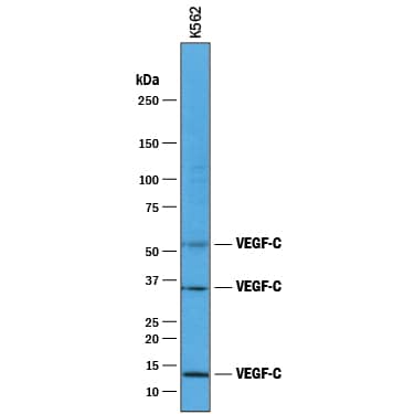 Western blot shows lysates of K562 human chronic myelogenous leukemia cell line. PVDF membrane was probed with 1 µg/mL of Goat Anti-Human VEGF-C Antigen Affinity-purified Polyclonal Antibody (Catalog # AF752) followed by HRP-conjugated Anti-Goat IgG Secondary Antibody (HAF017). Specific bands were detected for VEGF-C at approximately 52 kDa, 34 kDa, and 13 kDa (as indicated). This experiment was conducted under reducing conditions and using Immunoblot Buffer Group 1.
