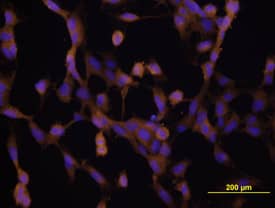 VEGF was detected in immersion fixed human umbilical vein endothelial cells (HUVECs) using Goat Anti-Human VEGF165 Antigen Affinity-purified Polyclonal Antibody (Catalog # AF-293-NA) at 10 µg/mL for 3 hours at room temperature. Cells were stained using the NorthernLights™ 557-conjugated Anti-Goat IgG Secondary Antibody (yellow; NL001) and counter-stained with DAPI (blue). View our protocol for Fluorescent ICC Staining of Non-adherent Cells.