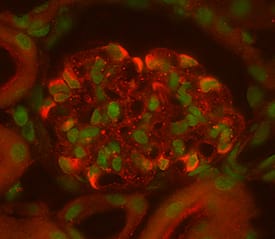 Vascular Endothelial Growth Factor 164 (VEGF164) was detected in perfusion fixed frozen sections of mouse kidney using Goat Anti-Mouse VEGF164Antigen Affinity-purified Polyclonal Antibody (Catalog # AF-493-NA) at 15 µg/mL overnight at 4 °C. Tissue was stained (red) and counterstained (green). View our protocol for Fluorescent IHC Staining of Frozen Tissue Sections.