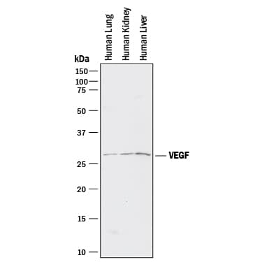 Western blot shows lysates of human lung tissue, human kidney tissue, and human liver tissue. PVDF membrane was probed with 5-10 µg/mL of Goat Anti-Human VEGF 165Antigen Affinity-purified Polyclonal Antibody (Catalog # AF-293-NA) followed by HRP-conjugated Anti-Goat IgG Secondary Antibody (HAF017). A specific band was detected for VEGF at approximately 27 kDa (as indicated). This experiment was conducted under reducing conditions and using Immunoblot Buffer Group 1.