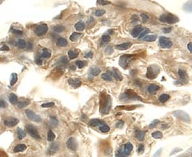 VEGF164was detected in perfusion fixed frozen sections of rat kidney using 15 µg/mL Goat Anti-Rat VEGF164Antigen Affinity-purified Polyclonal Antibody (Catalog # AF564) overnight at 4 °C. Tissue was stained with the Anti-Goat HRP-DAB Cell & Tissue Staining Kit (brown; Catalog # CTS008) and counterstained with hematoxylin (blue). View our protocol for Chromogenic IHC Staining of Frozen Tissue Sections.