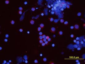 VEGF was detected in immersion fixed canine peripheral blood mononuclear cells (PBMCs) using Mouse Anti-Canine VEGF Monoclonal Antibody (Catalog # MAB1603) at 10 µg/mL for 3 hours at room temperature. Cells were stained using the NorthernLights™ 557-conjugated Anti-Mouse IgG Secondary Antibody (red; Catalog # NL007) and counterstained with DAPI (blue). View our protocol for Fluorescent ICC Staining of Non-adherent Cells.