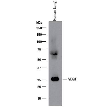 Western blot shows lysates of human lung tissue. PVDF membrane was probed with 2 µg/mL of Recombinant Mouse Anti-Human/Primate VEGF Monoclonal Antibody (Catalog # MAB293R) followed by HRP-conjugated Anti-Mouse IgG Secondary Antibody (Catalog # HAF018). A specific band was detected for VEGF at approximately 25 kDa (as indicated). This experiment was conducted under reducing conditions and using Immunoblot Buffer Group 1.