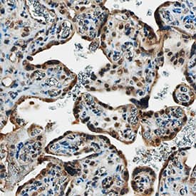 VEGF165bwas detected in immersion fixed paraffin-embedded sections of human placenta using Mouse Anti-Human VEGF165bMonoclonal Antibody (Catalog # MAB3045) at 15 µg/mL overnight at 4 °C. Tissue was stained using the Anti-Mouse HRP-DAB Cell & Tissue Staining Kit (brown; Catalog # CTS002) and counterstained with hematoxylin (blue). Specific staining was localized to syncytiotrophoblasts. View our protocol for Chromogenic IHC Staining of Paraffin-embedded Tissue Sections.