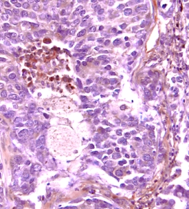 Immunohistochemistry VEGFR1/Flt-1 Antibody [Unconjugated]