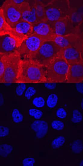 <b>Biological Strategies Validation. </b>VEGFR2/KDR/Flk-1 phosphorylated at Y1214 was detected in immersion fixed A431 human epithelial carcinoma cell line untreated (lower panel) or treated (upper panel) with pervanadate using Rabbit Anti-Human Phospho-VEGFR2/KDR/Flk-1 (Y1214) Antigen Affinity-purified Polyclonal Antibody (Catalog # AF1766) at 10 µg/mL for 3 hours at room temperature. Cells were stained using the NorthernLights™ 557-conjugated Anti-Rabbit IgG Secondary Antibody (red; NL004) and counterstained with DAPI (blue). View our protocol for Fluorescent ICC Staining of Cells on Coverslips.