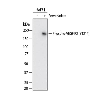 Western Blot shows lysates of A431 human epithelial carcinoma cell line untreated (-) or treated (+) with 100 μM pervanadate (PV) for 10 minutes. PVDF membrane was probed with 1 µg/ml of Rabbit Anti-Human Phospho-VEGFR2/KDR/Flk-1 (Y1214) Antigen Affinity-purified Polyclonal Antibody (Catalog # AF1766) followed by HRP-conjugated Anti-Rabbit IgG Secondary Antibody (Catalog # HAF008). A specific band was detected for VEGFR2/KDR/Flk-1 at approximately 230 kDa (as indicated).  This experiment was conducted under reducing conditions and using Western Blot Buffer Group 1.