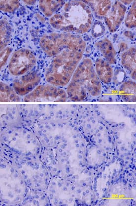VEGFR2/KDR/Flk-1 was detected in immersion fixed paraffin-embedded sections of human kidney using Goat Anti-Human VEGFR2/KDR/Flk-1 Antigen Affinity-purified Polyclonal Antibody (Catalog # AF357) at 10 µg/mL overnight at 4 °C. Tissue was stained using the Anti-Goat HRP-DAB Cell & Tissue Staining Kit (brown; Catalog # CTS008) and counterstained with hematoxylin (blue). Lower panel shows a lack of labeling if primary antibodies are omitted and tissue is stained only with secondary antibody followed by incubation with detection reagents. View our protocol for Chromogenic IHC Staining of Paraffin-embedded Tissue Sections.