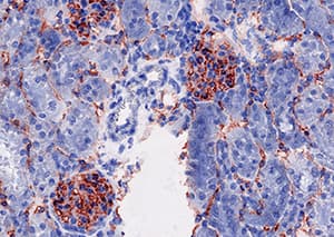 VEGFR2 was detected in acetone fixed cryosections of mouse kidney tissue using Goat Anti-Mouse VEGFR2/KDR/Flk-1 Polyclonal Antibody (Catalog # AF644) for 50 minutes at room temperature. Tissues were stained with rabbit anti-goat secondary antibody and HRP polymer-conjugated anti-rabbit IgG followed by AEC+Substrate Chromogen (red) followed by counterstaining with hematoxylin (blue). Experiments were carried out and the image was provided by Dr. Grietje Molema, University Medical Center Groningen, The Netherlands.