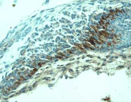 VEGFR2/KDR/Flk-1 was detected in immersion fixed frozen sections of mouse embryo (14 d.p.c.) using 15 µg/mL Goat Anti-Mouse VEGFR2/KDR/Flk-1 Antigen Affinity-purified Polyclonal Antibody (Catalog # AF644) overnight at 4 °C. Tissue was stained with the Anti-Goat HRP-DAB Cell & Tissue Staining Kit (brown; Catalog # CTS008) and counterstained with hematoxylin (blue). Specific labeling was localized to mesenchymal cells. View our protocol for Chromogenic IHC Staining of Frozen Tissue Sections.