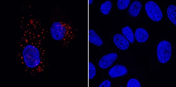 VEGFR2/KDR/Flk-1 was detected in immersion fixed human umbilical vein endothelial cells (HUVECs; left panel) but is not detected in Hela human cervical epithelial carcinoma cell line (right panel) using Mouse Anti-Human VEGFR2/KDR/Flk-1 Monoclonal Antibody (Catalog # MAB3571) at 8 µg/mL for 3 hours at room temperature. Cells were stained using the NorthernLights™ 557-conjugated Anti-Mouse IgG Secondary Antibody (red; Catalog # NL007) and counterstained with DAPI (blue). Specific staining was localized to cytoplasm of HUVECs. View our protocol for Fluorescent ICC Staining of Cells on Coverslips.