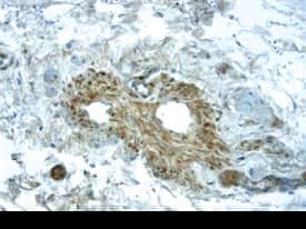 VEGFR2/KDR/Flk-1 was detected in immersion fixed paraffin-embedded sections of human placenta using 25 µg/mL Human VEGFR2/KDR/Flk-1 Monoclonal Antibody (Catalog # MAB3571) overnight at 4 °C. Tissue was stained with the Anti-Mouse HRP-DAB Cell & Tissue Staining Kit (brown; Catalog # CTS002) and counterstained with hematoxylin (blue). View our protocol for Chromogenic IHC Staining of Paraffin-embedded Tissue Sections.