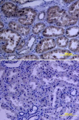 VEGFR2/KDR/Flk-1 was detected in immersion fixed paraffin-embedded sections of human kidney array using Human VEGFR2/KDR/Flk-1 Monoclonal Antibody (Catalog # MAB3571) at 15 µg/mL overnight at 4 °C. Tissue was stained using the Anti-Mouse HRP-DAB Cell & Tissue Staining Kit (brown; Catalog # CTS002) and counterstained with hematoxylin (blue). Lower panel shows a lack of labeling if primary antibodies are omitted and tissue is stained only with secondary antibody followed by incubation with detection reagents. View our protocol for Chromogenic IHC Staining of Paraffin-embedded Tissue Sections.
