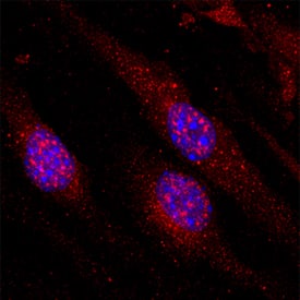 VG5Q was detected in immersion fixed bEnd.3 mouse endothelioma cell line using Rat Anti-Mouse VG5Q Monoclonal Antibody (Catalog # MAB30481) at 10 µg/mL for 3 hours at room temperature. Cells were stained using the NorthernLights™ 557-conjugated Anti-Rat IgG Secondary Antibody (red; Catalog # NL013) and counterstained with DAPI (blue). Specific staining was localized to cytoplasm and nuclei. View our protocol for Fluorescent ICC Staining of Cells on Coverslips.