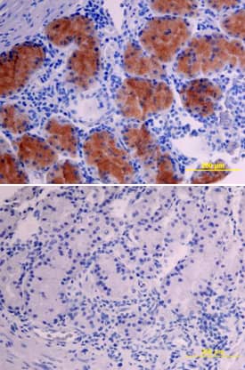 VIP was detected in immersion fixed paraffin-embedded sections of human stomach array using Mouse Anti-Human VIP Monoclonal Antibody (Catalog # MAB6079) at 15 µg/mL overnight at 4 °C. Tissue was stained using the Anti-Mouse HRP-DAB Cell & Tissue Staining Kit (brown; Catalog # CTS002) and counterstained with hematoxylin (blue). Lower panel shows a lack of labeling if primary antibodies are omitted and tissue is stained only with secondary antibody followed by incubation with detection reagents. View our protocol for Chromogenic IHC Staining of Paraffin-embedded Tissue Sections.
