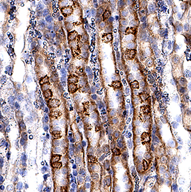 VLDL R was detected in perfusion fixed frozen sections of mouse kidney using Goat Anti-Mouse VLDL R Antigen Affinity-purified Polyclonal Antibody (Catalog # AF2258) at 3 µg/mL for 1 hour at room temperature followed by incubation with the Anti-Goat IgG VisUCyte™ HRP Polymer Antibody (Catalog # VC004). Tissue was stained using DAB (brown) and counterstained with hematoxylin (blue). Specific staining was localized to cell membranes of convoluted tubules. View our protocol for IHC Staining with VisUCyte HRP Polymer Detection Reagents.