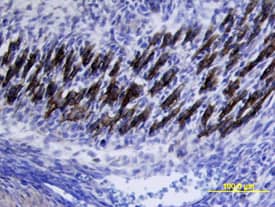 Immunohistochemistry VLDLR Antibody [Unconjugated]